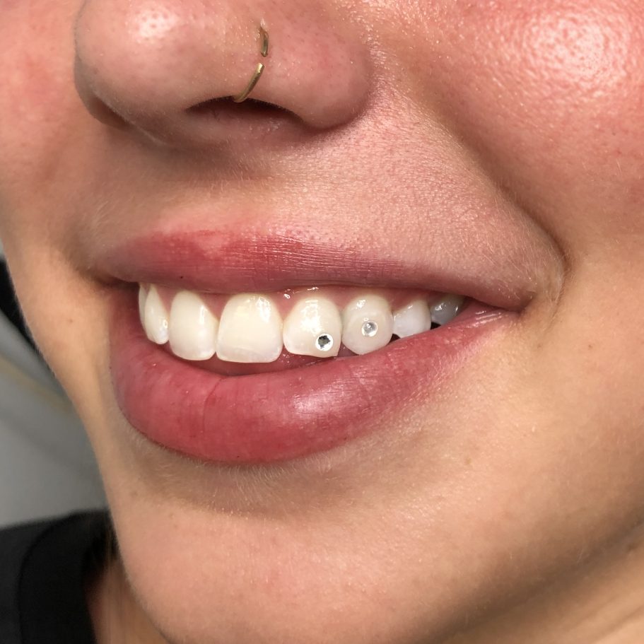 Tooth Gems London